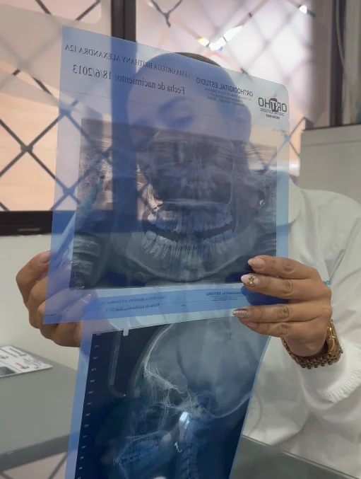 Colocación de brackets con el equipo en consulta